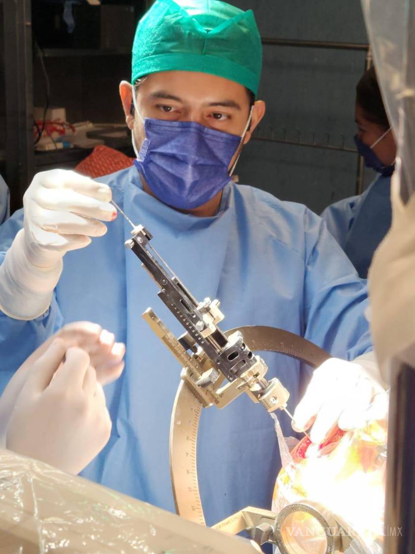 $!Ya en el cerebro, el cirujano coloca el dispositivo que emitirá en adelante los impulsos eléctricos.