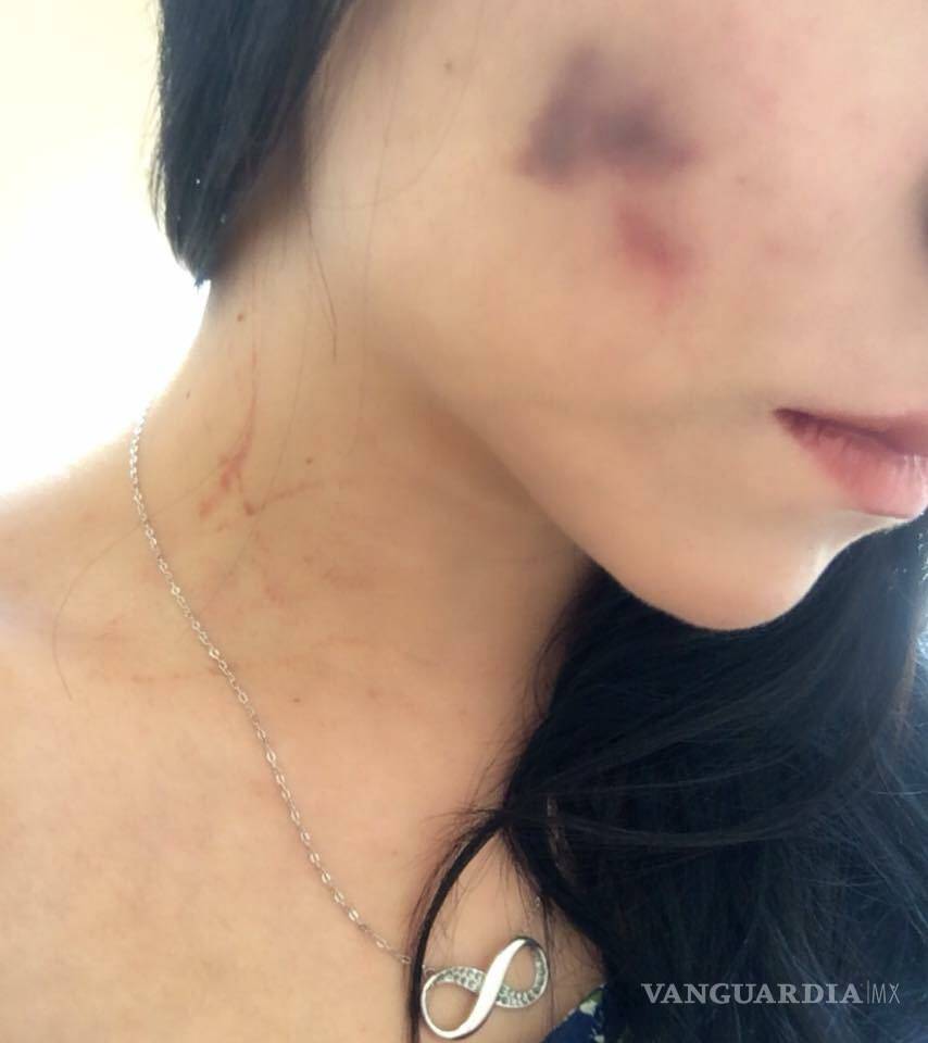 $!Porrista de Saraperos denuncia golpiza de su novio