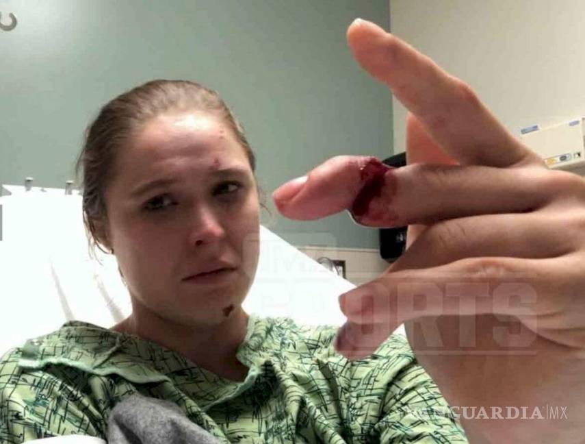 $!Ronda Rousey a punto de perder el dedo en México (foto)