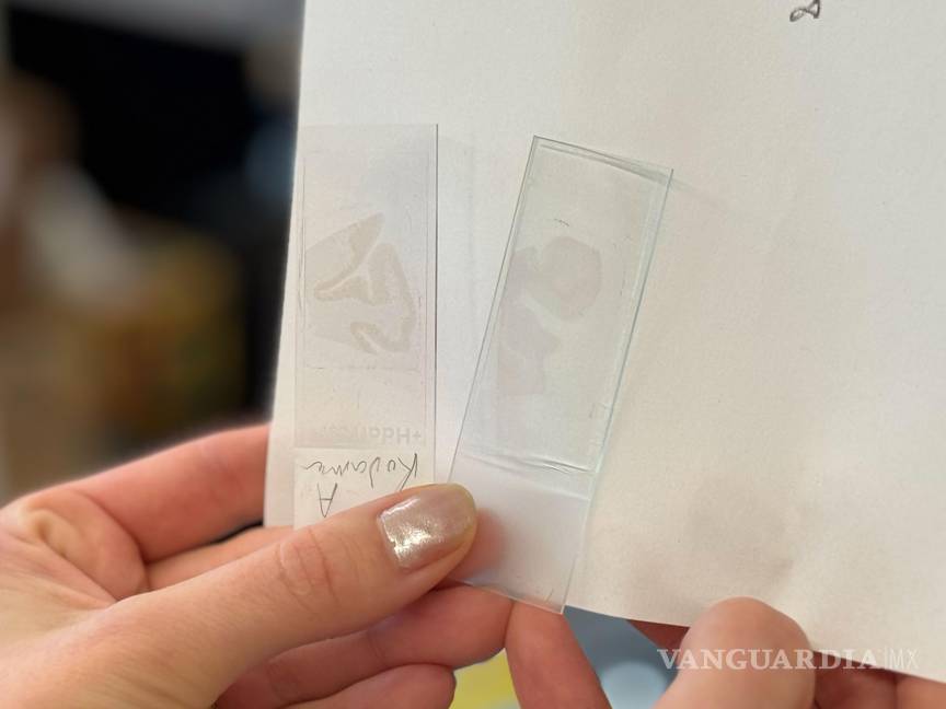 $!En la diapositiva de la izquierda, que contiene tejido cerebral con Alzheimer sin tratamiento. La de la derecha, que contiene tejido cerebral tratado con fármacos.