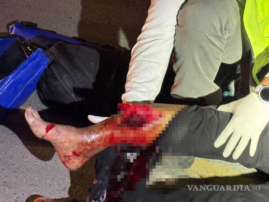 $!La mujer sufrió una fractura expuesta en la pierna derecha a causa del impacto del vehículo.