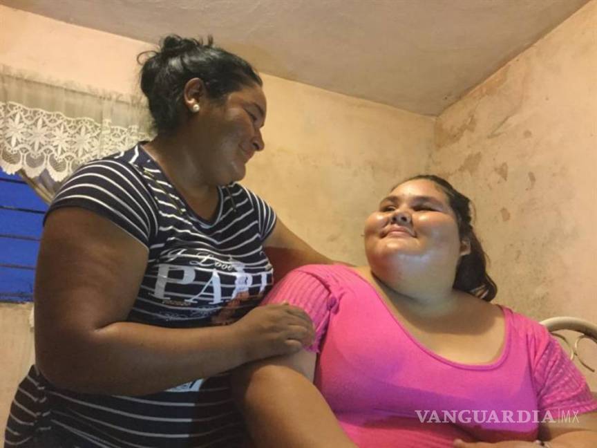 $!Dayana, 14 años, 195 kilos y un by-pass gástrico para mejorar su vida