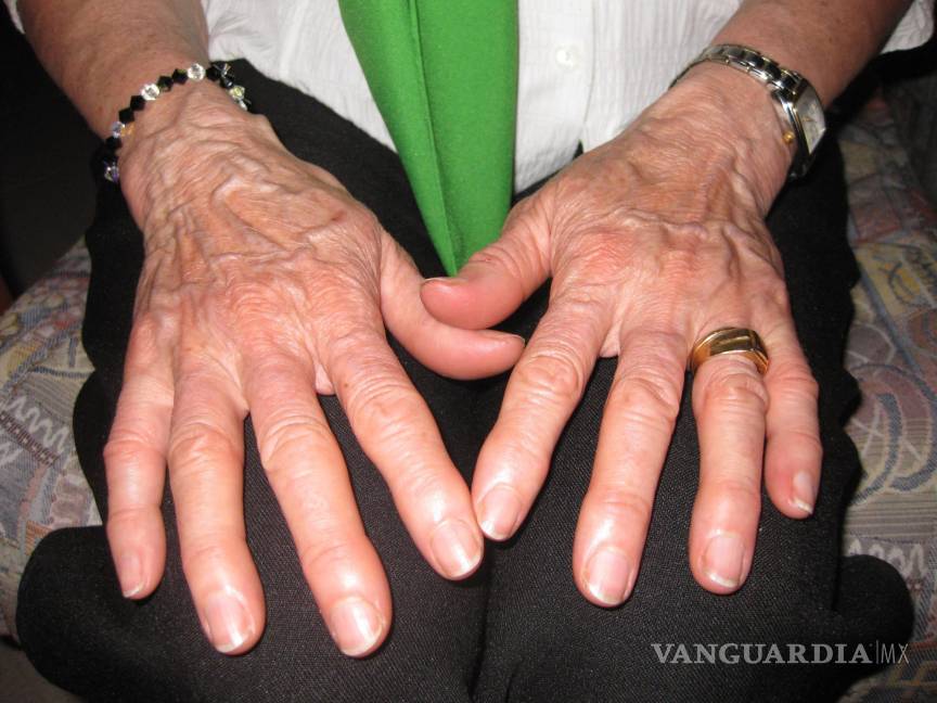 $!Temblor y lentitud de movimientos son algunos de los sintomas con los que se presenta la enfermedad de Parkinson.