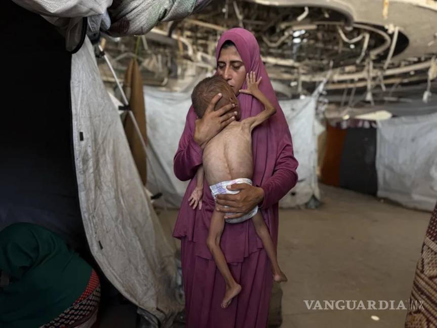 $!Un niño gazatí de 18 meses, de cuerpo esquelético, en brazos de su madre en una imagen del 26 de julio de 2025.
