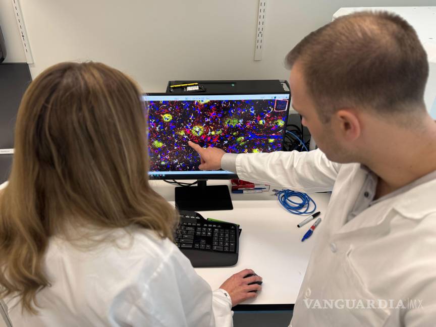 $!Los autores del estudio, David Gate (izquierda) y Lynn van Olst (derecha), examinan una imagen de computadora de un cerebro humano con enfermedad de Alzheimer que había sido tratado con inmunización contra la beta amiloide.