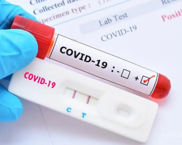 En laboratorios privados de la localidad se ha reportado escasez de pruebas para COVID-19 e influenza.