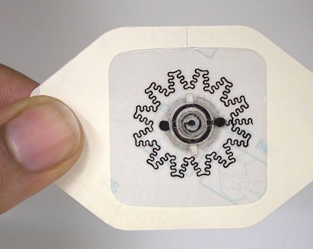 El apósito hidráulico sin electrónica (WPED) que estimula eléctricamente los tejidos promueve la cicatrización de las heridas crónicas.