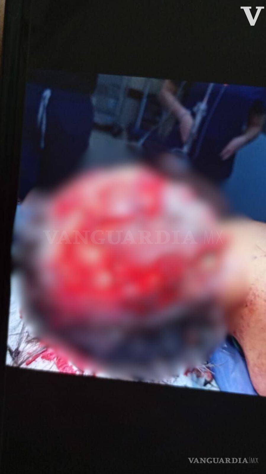 $!Las graves lesiones en el cuero cabelludo mantuvieron a la menor en el quirófano durante seis horas.