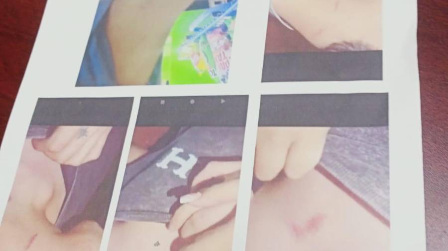 La madre del menor presuntamente agredido en una taquería de Saltillo, denunció los hechos ante la Fiscalía General del Estado (FGE) con evidencias de los daños físicos provocados a su hijo.