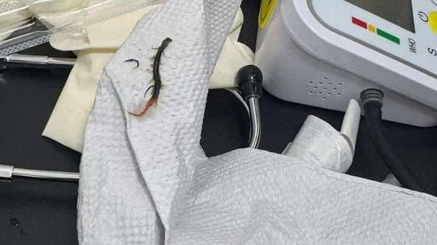 Con ayuda de instrumental médico especializado, la especialista logró retirar por completo el ciempiés que provocaba las molestias de la menor, quien posteriormente quedó fuera de peligro tras la intervención.
