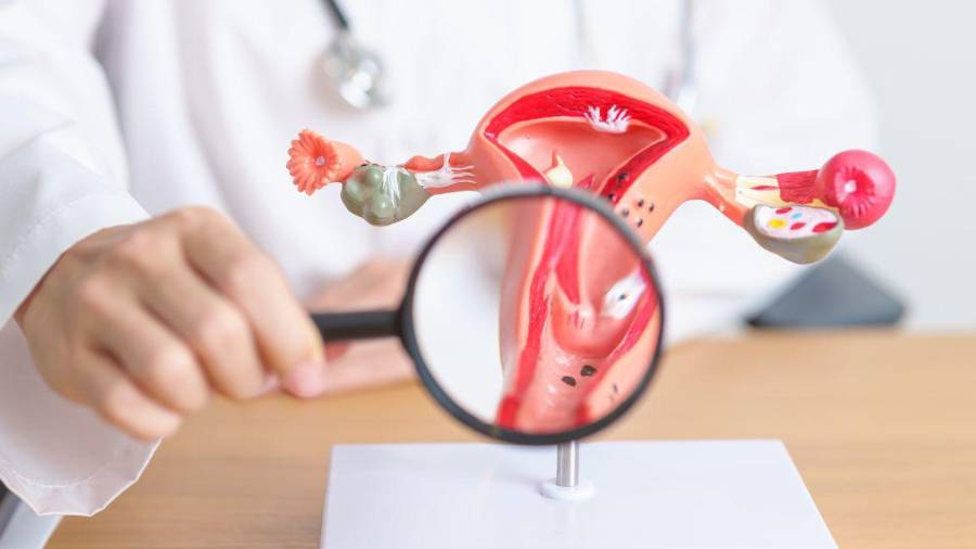 The Lancet impulsa cambiar SOP por PMOS para mejorar diagnósticos, reducir estigmas y visibilizar efectos hormonales y metabólicos.