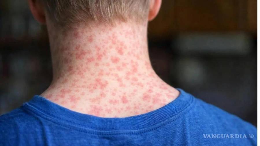 El repunte de casos mantiene en observación a menores no vacunados y población vulnerable.