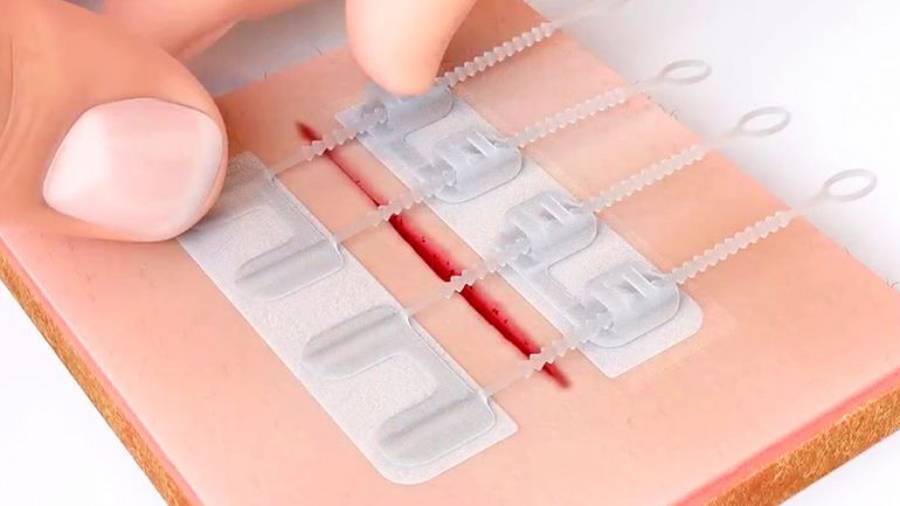 ZipStitch, con este dispositivo podrás cerrar heridas sin sutura
