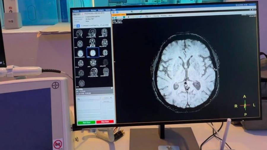 El Código Cerebro busca reducir los tiempos de respuesta ante eventos como embolias cerebrales y disminuir el riesgo de discapacidad.