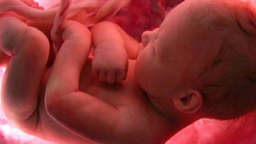 Realizan la primera neurocirugía en México a un feto de 6 meses de gestación