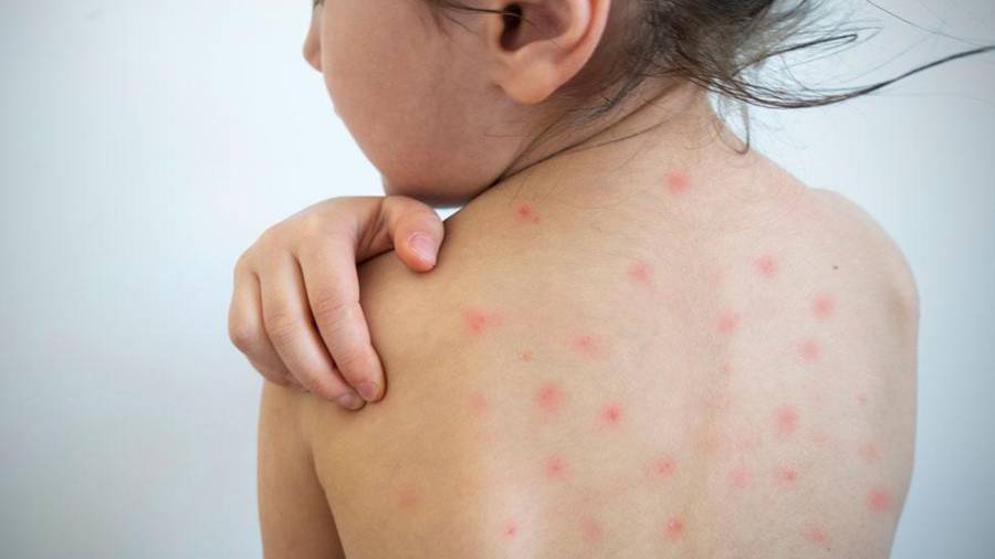 Autoridades de la Secretaría de Salud de Coahuila informaron que el estado atraviesa una fase de estabilización epidemiológica.