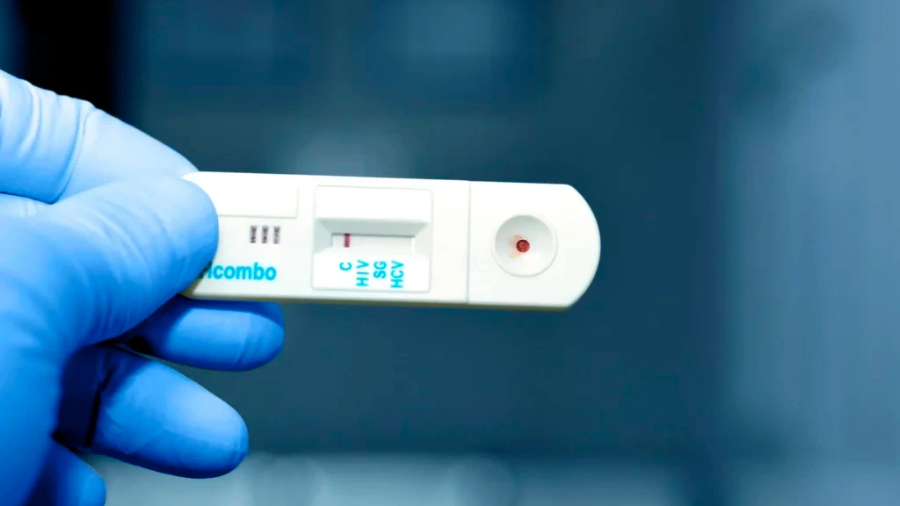 En contraste, los contagios de herpes genital experimentaron una disminución en el mismo periodo.