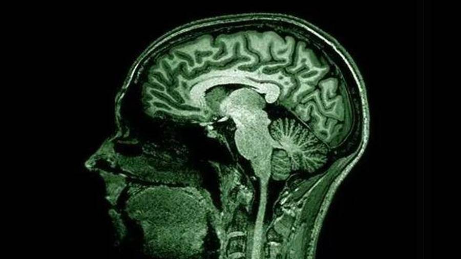 Los investigadores descubrieron que un mal funcionamiento del sistema que se encarga de limpiar el cerebro podría ser la causa de diversas patologías neurodegenerativas, tales como el alzhéimer.