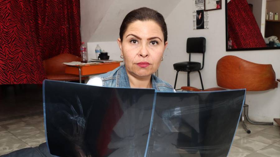 Violencia. Las heridas de Iris tras la agresión de Pepe van desde hematomas, golpes hasta fracturas que han necesitado de cirugía.