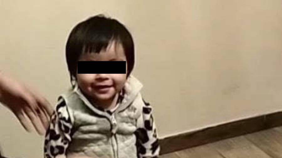 Especialistas preparan a la bebé para cirugías e injertos de piel, como parte del tratamiento tras el accidente doméstico ocurrido en Ciudad Frontera.