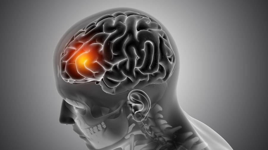 El control médico periódico permite identificar oportunamente alteraciones que elevan el riesgo de un evento cerebrovascular.