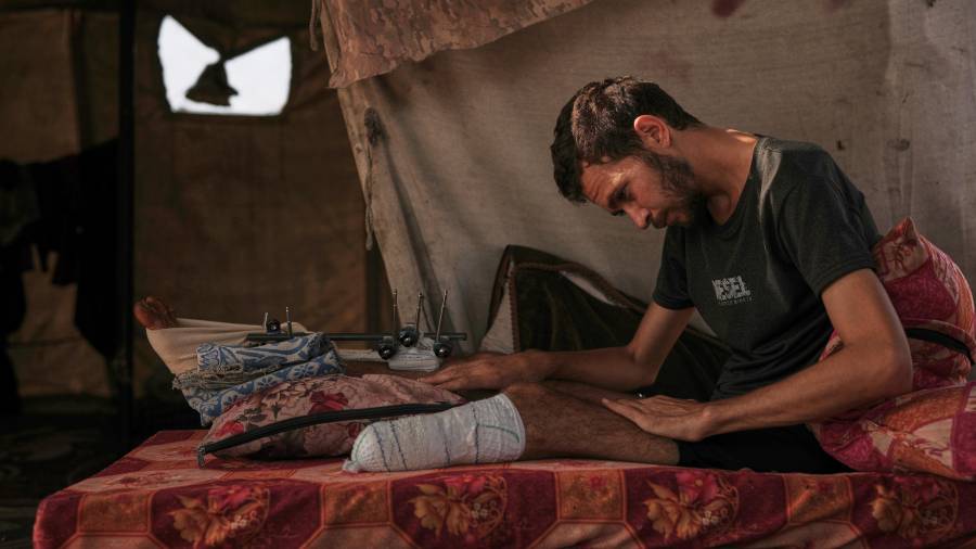 Yassin Marouf, de 23 años, quien perdió el pie izquierdo y sufrió una grave lesión en la pierna derecha tras ser impactado por un bombardeo israelí en mayo, está en una tienda de campaña en Zawaida, Gaza.