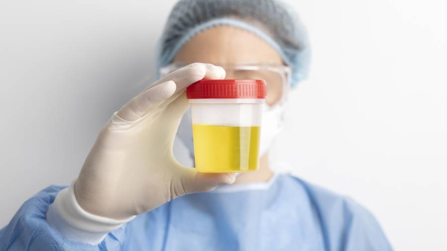 Los análisis de orina convencionales permiten identificar la bacteria causante de una infección urinaria al cabo de 36 horas.