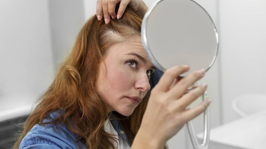 La mayor visibilidad del cuero cabelludo bajo luz directa es una señal notoria de que una mujer esta padeciendo alopecia.
