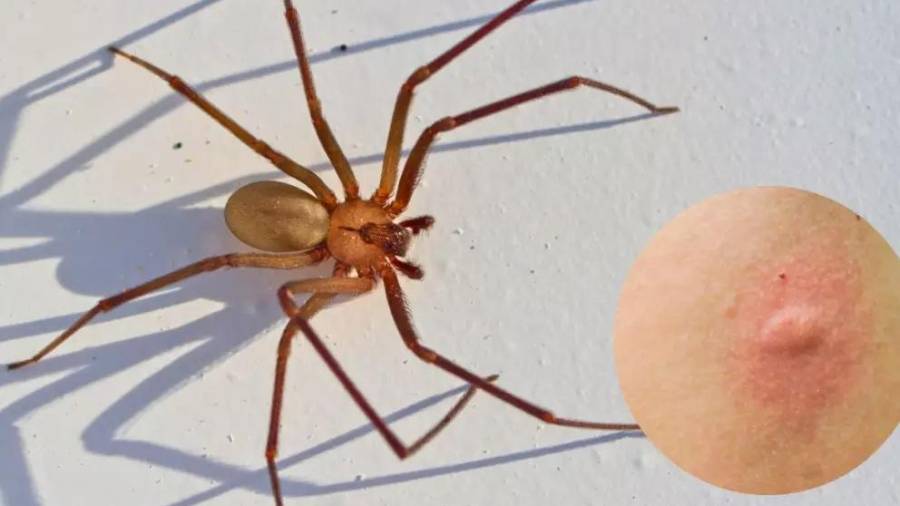 Especialistas recomendaron reforzar medidas de prevención en los hogares, como fumigaciones periódicas y revisión de espacios cerrados.