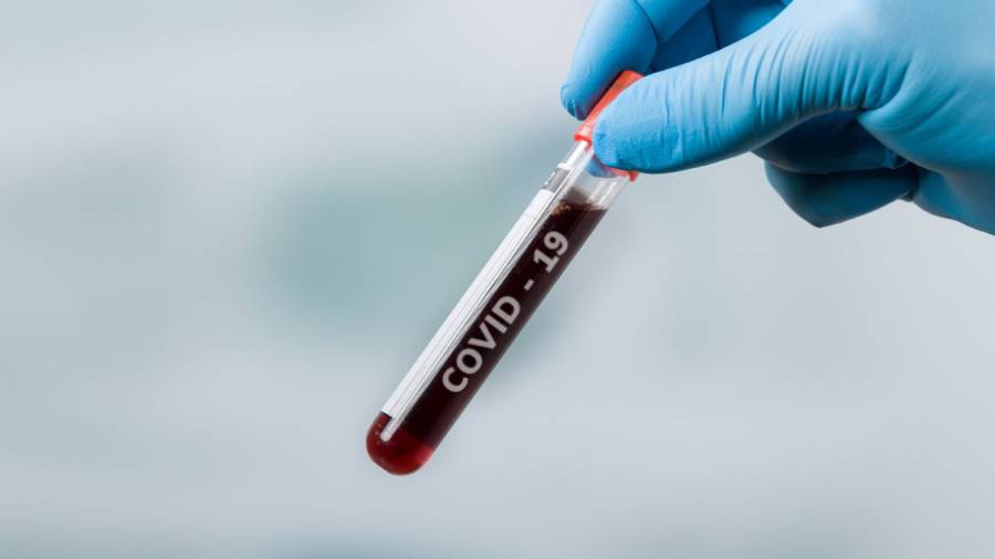 ¿Se puede aprender algo del COVID-19?