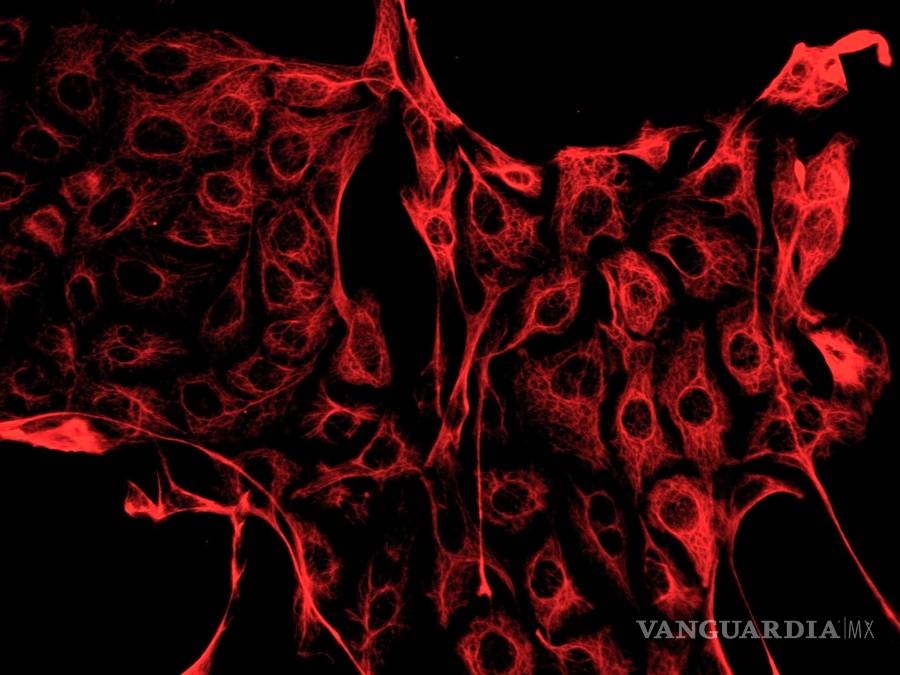 $!Cultivando células mamarias logran desarrollar la primera leche materna hecha en un laboratorio