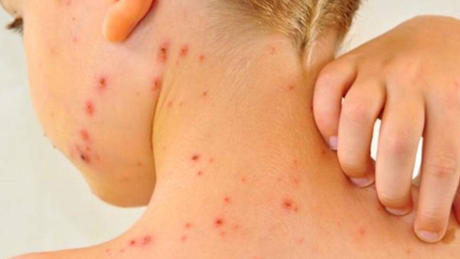 Coahuila busca alcanzar una cobertura de vacunación del 95% para garantizar la inmunidad colectiva en todas las regiones del estado.