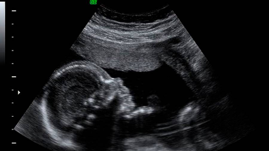 ¿Cuánto cuesta tener un bebé en la CDMX?