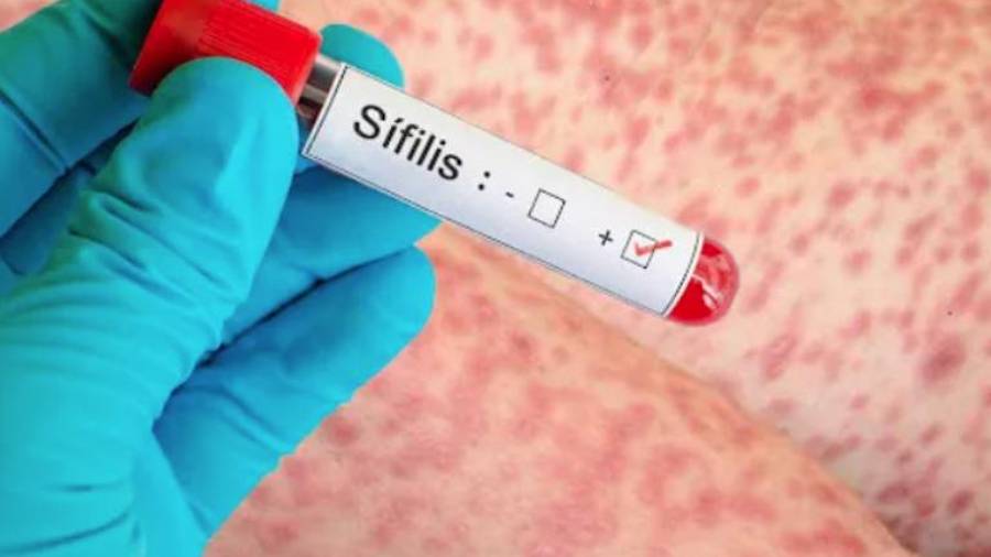 El mayor incremento se presentó en la segunda semana de febrero, con 149 nuevos diagnósticos en la entidad.