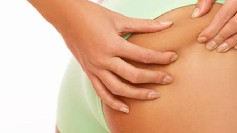 La liposucción no es apta en personas con obesidad