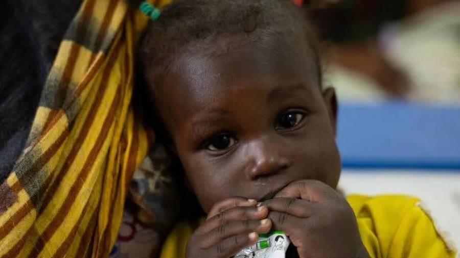 Un bebé de un año recibe tratamiento para la desnutrición en Sudán.