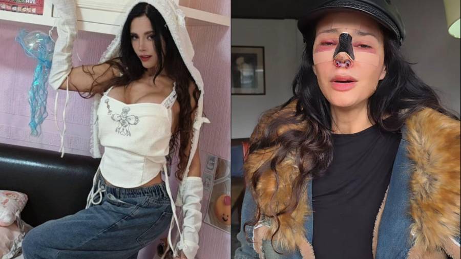 La reconocida modelo argentina y conductora de Televisa, Dora Noemí Kerchen, mejor conocida como Dorismar, denunció haber sido víctima de una “mala praxis” tras una cirugía estética.