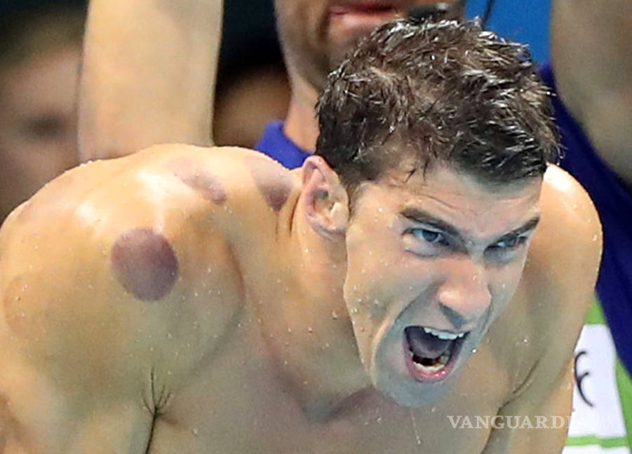 $!Te explicamos la razón de las extrañas marcas que tiene Michael Phelps en su cuerpo