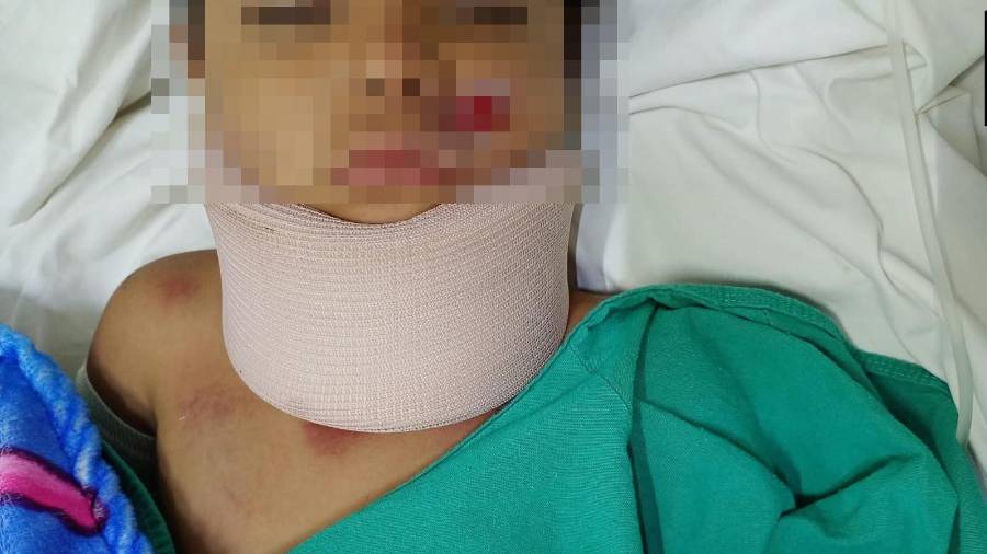 Familiares del menor solicitaron apoyo para localizar al conductor involucrado en el percance.