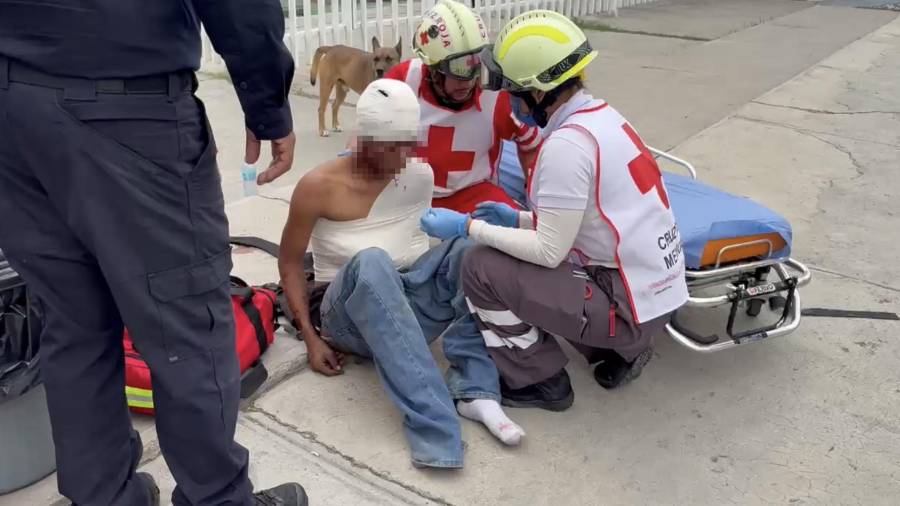 Francisco Manuel, conocido como “El Pingüino”, fue localizado con lesiones en el rostro frente al parque La Maquinita.