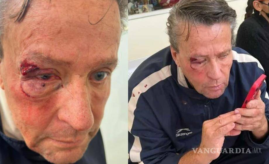 $!“Estoy ahorita en la fiscalía porque les voy a levantar la denuncia por lesiones, injurias, amenazas, por todo... Se van para adentro”, dijo.