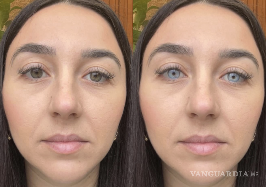 $!Los oftalmólogos alertan que estas cirugías pueden causar daños permanentes en la vista.