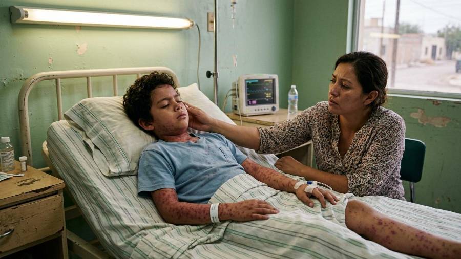 La rickettsiosis puede iniciar con fiebre alta, dolor de cabeza y malestar general, síntomas que pueden confundirse con otros padecimientos.