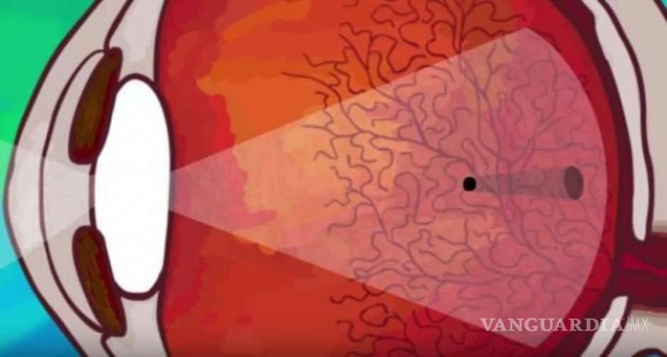 $!No es una "basurita", descubre qué pasa con tu visión