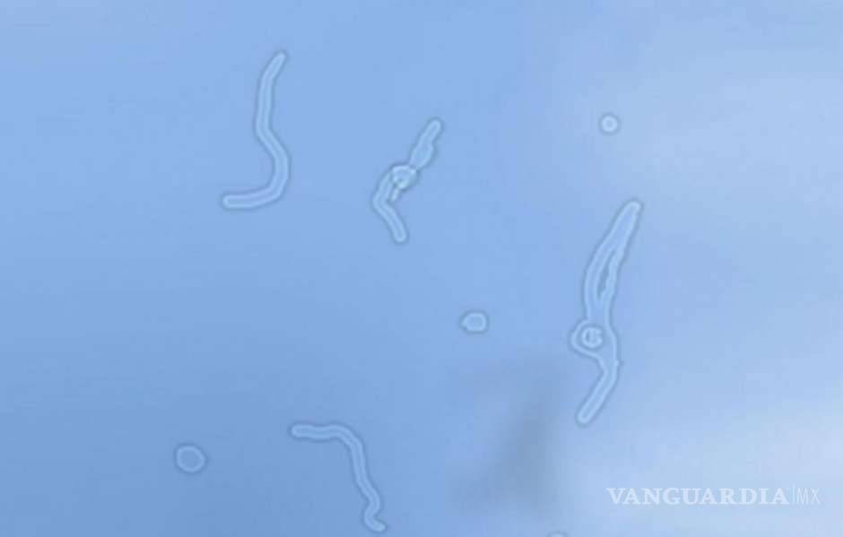 $!No es una "basurita", descubre qué pasa con tu visión