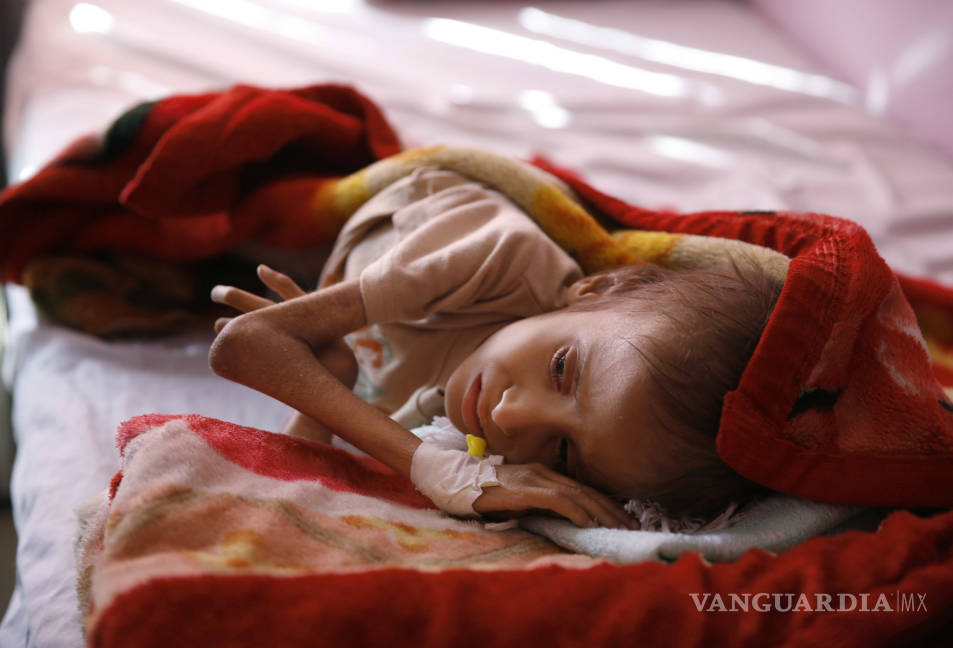 $!130 niños o más mueren cada día en Yemen: Save the Children