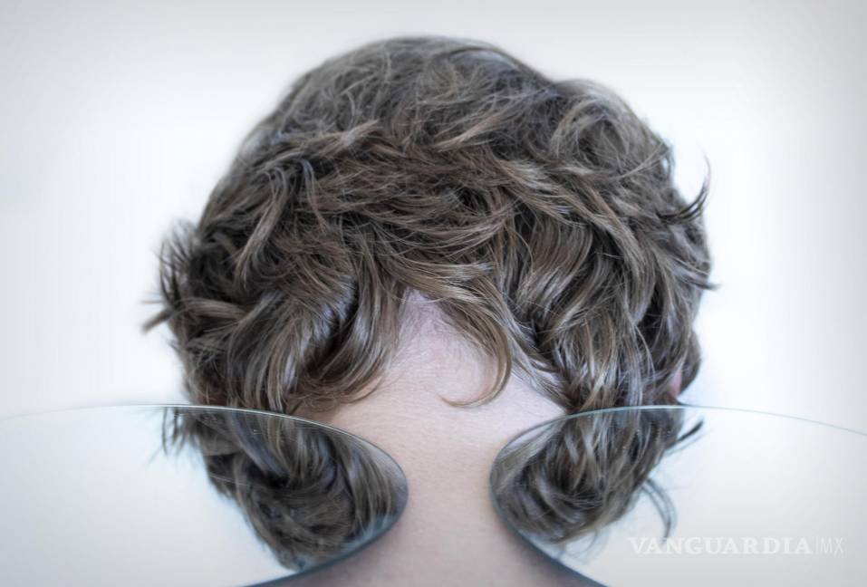 $!El estrés también podía causar o empeorar otros padecimientos que conducen a la pérdida de cabello, como la alopecia areata.