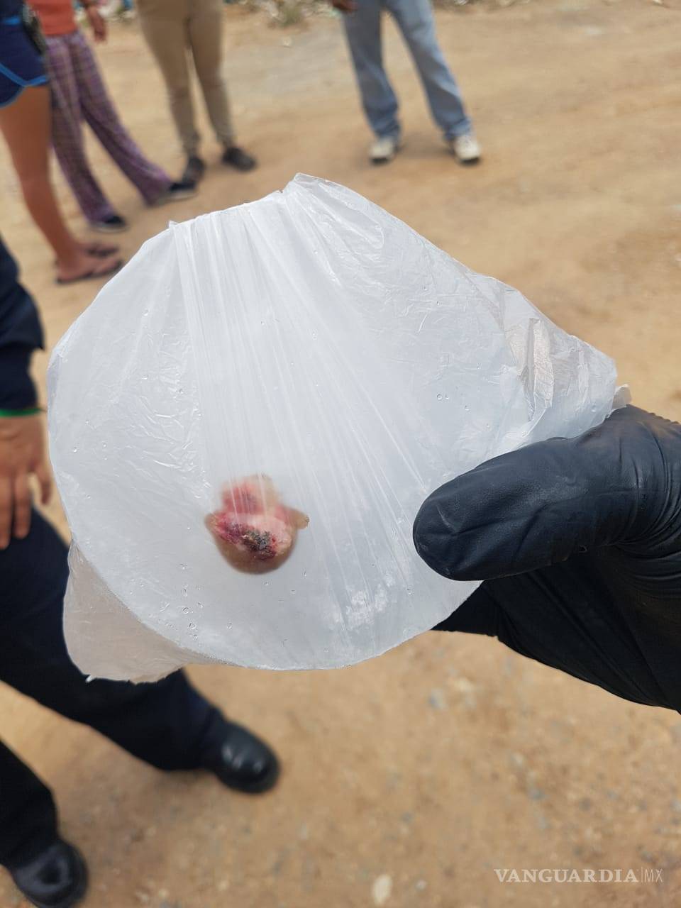 $!Ataca perro a peatón y le arranca un dedo