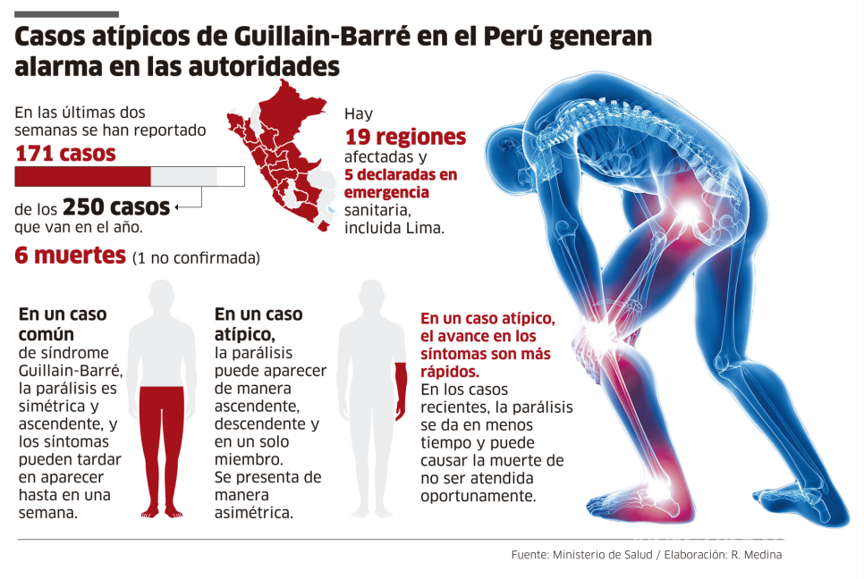 $!Guillain-Barré, ¿qué es este síndrome que tiene a Perú en emergencia sanitaria?