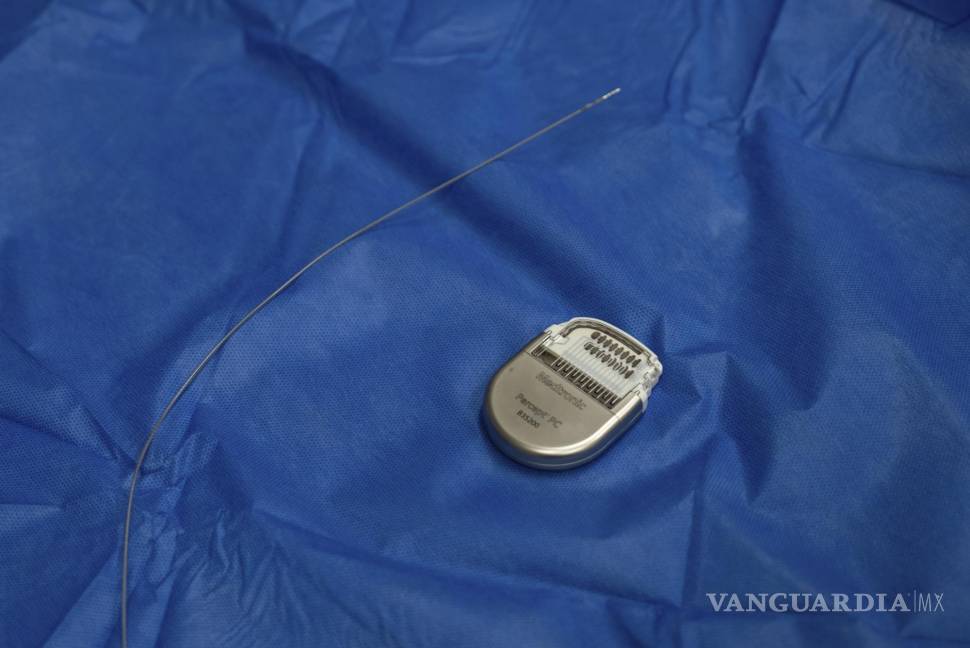 $!Una muestra de un dispositivo similar a un marcapasos, utilizado para la terapia de estimulación cerebral profunda.